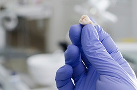 Gloved hand holding extracted wisdom tooth