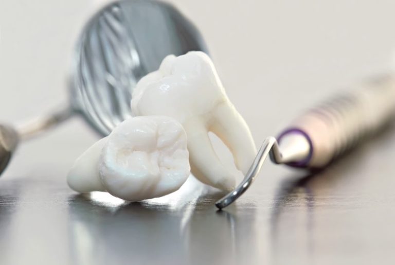 Do Tooth Extractions Treat Gum Disease?